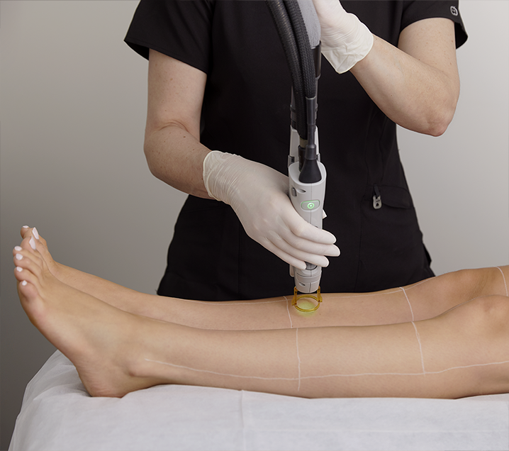 Laser Hair Removal Treatments Laser Clinics New Zealand